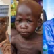 African Action Congress (ADC), Presidential Candidate Atiku Shame Tinubu Over Worsening Child-malnutrition Crisis