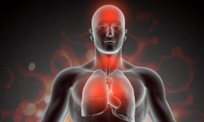 Lifestyles That Affect The Liver